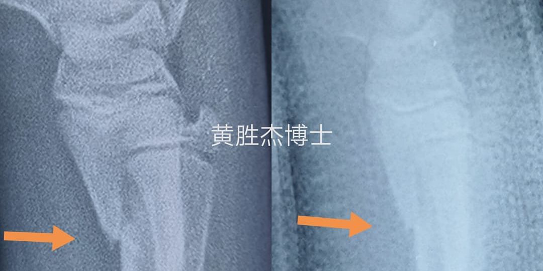 骨头